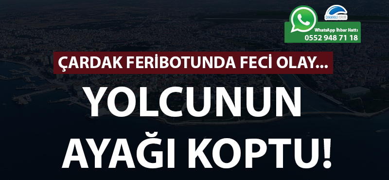 Çardak feribotunda feci olay: Yolcunun ayağı koptu!