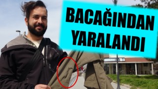 Barış Kordonu’nda sokak köpeği saldırısı!