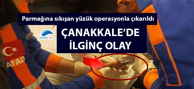 Çanakkale'de ilginç olay: Parmağına sıkışan yüzük operasyonla çıkarıldı