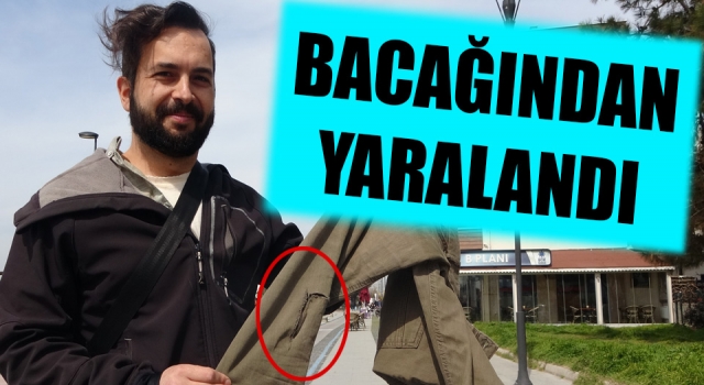 Barış Kordonu’nda sokak köpeği saldırısı!