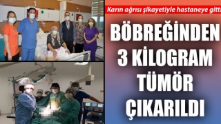 Karın ağrısı şikayetiyle hastaneye gitti: Böbreğinden 3 kilogram tümör çıkarıldı